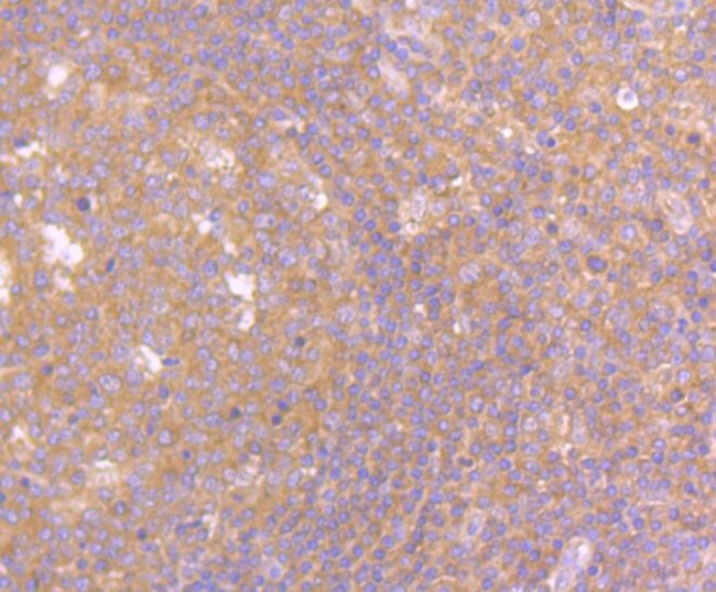 PEN2 Antibody in Immunohistochemistry (Paraffin) (IHC (P))