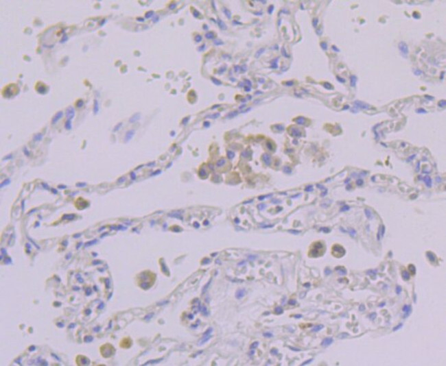 PEN2 Antibody in Immunohistochemistry (Paraffin) (IHC (P))