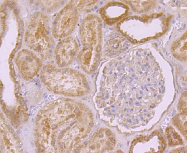 PEN2 Antibody in Immunohistochemistry (Paraffin) (IHC (P))