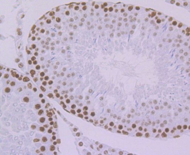 KHSRP Antibody in Immunohistochemistry (Paraffin) (IHC (P))