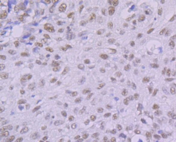 KHSRP Antibody in Immunohistochemistry (Paraffin) (IHC (P))