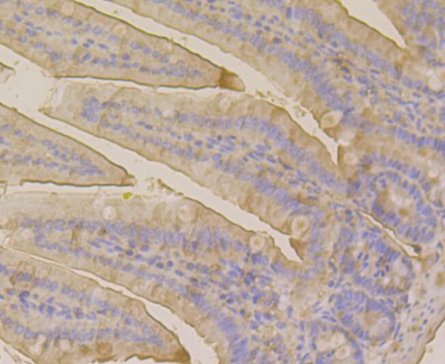 CLASP1 Antibody in Immunohistochemistry (Paraffin) (IHC (P))