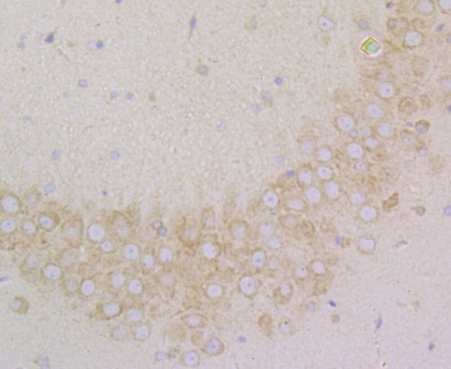 SRP54 Antibody in Immunohistochemistry (Paraffin) (IHC (P))