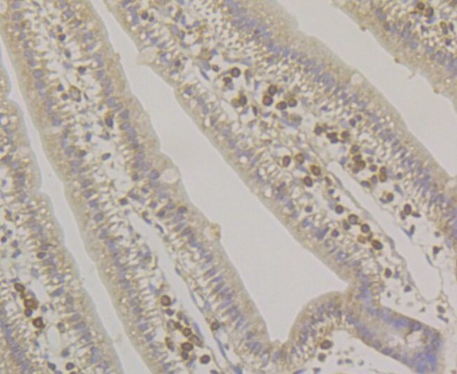 SRP54 Antibody in Immunohistochemistry (Paraffin) (IHC (P))