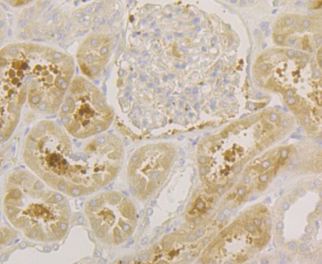 SRP54 Antibody in Immunohistochemistry (Paraffin) (IHC (P))