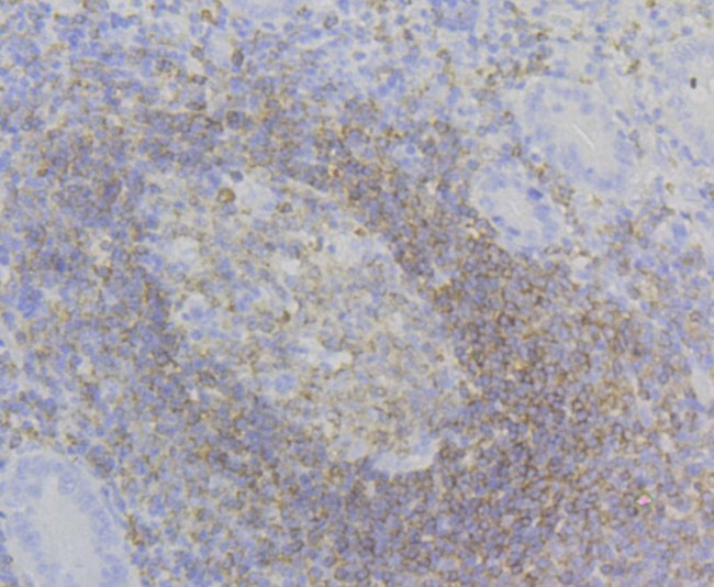 CD79a Antibody in Immunohistochemistry (Paraffin) (IHC (P))