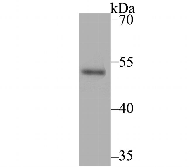 Brachyury Antibody in Western Blot (WB)