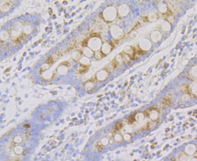 NDUFS4 Antibody in Immunohistochemistry (Paraffin) (IHC (P))