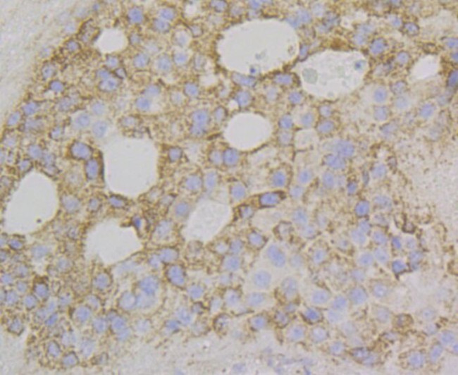 NDUFS4 Antibody in Immunohistochemistry (Paraffin) (IHC (P))