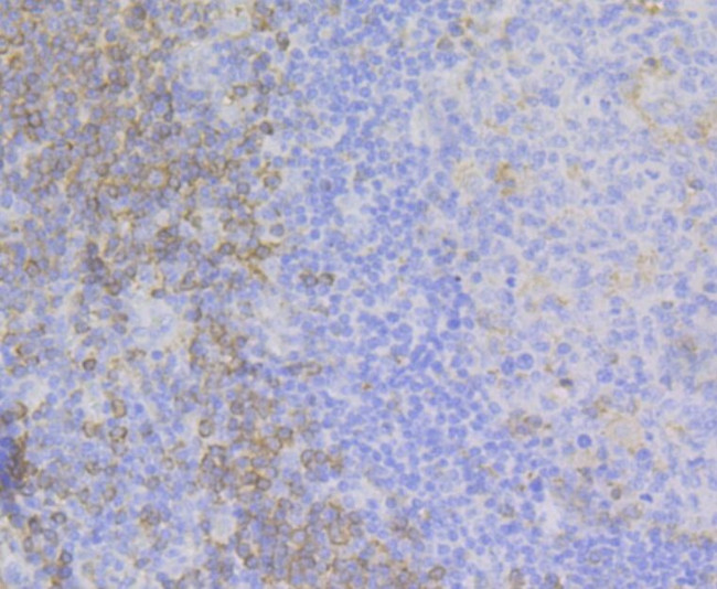 ADAP Antibody in Immunohistochemistry (Paraffin) (IHC (P))