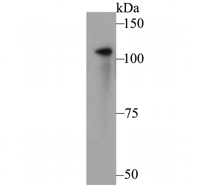 ADAP Antibody in Western Blot (WB)