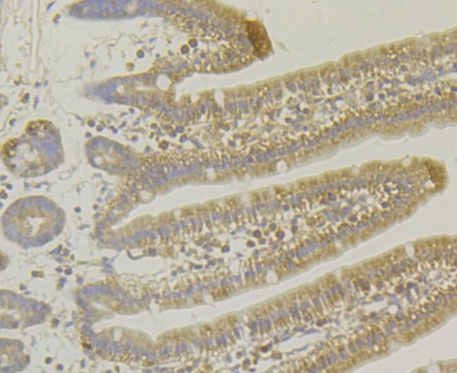 MARK3 Antibody in Immunohistochemistry (Paraffin) (IHC (P))