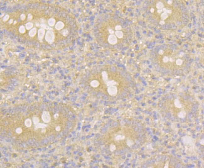 MARK3 Antibody in Immunohistochemistry (Paraffin) (IHC (P))