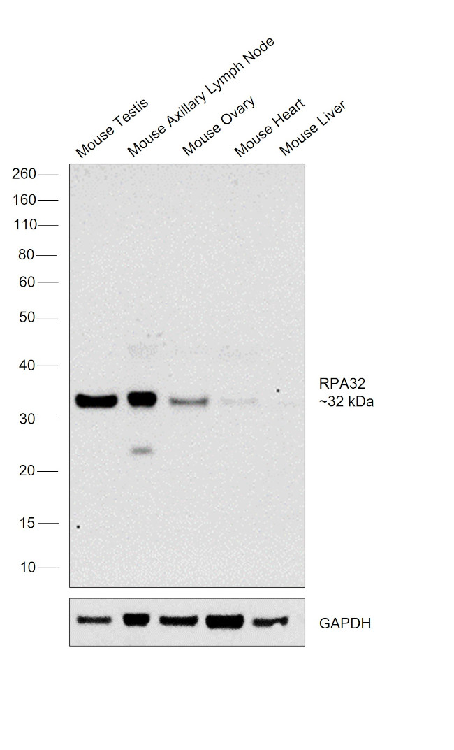 RPA2 Antibody