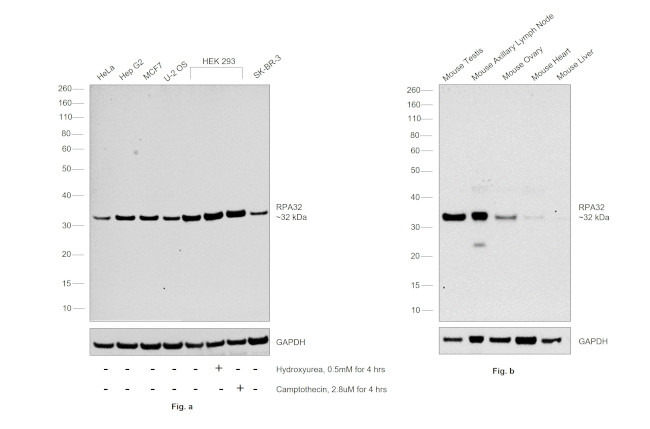 RPA2 Antibody in Western Blot (WB)