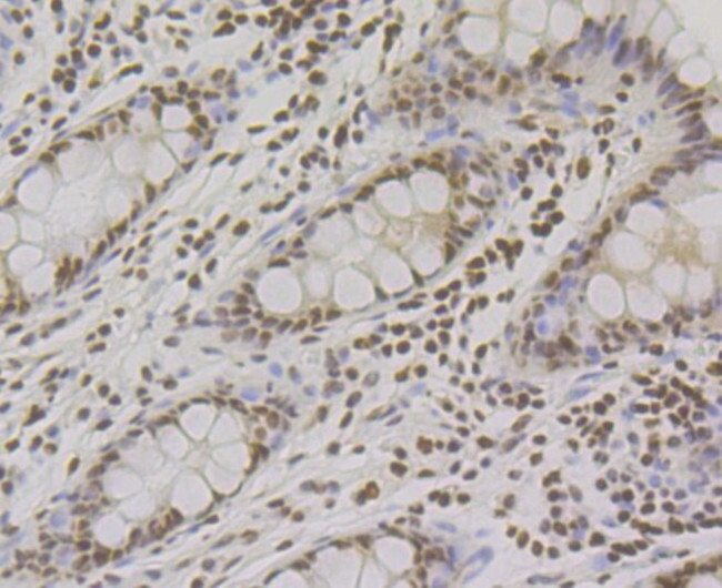 RPA2 Antibody in Immunohistochemistry (Paraffin) (IHC (P))