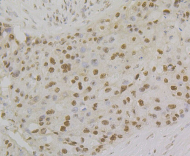 RPA2 Antibody in Immunohistochemistry (Paraffin) (IHC (P))