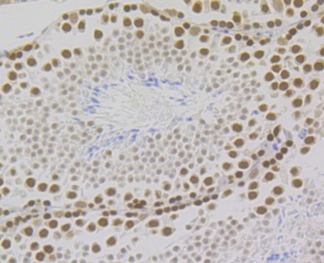 RPA2 Antibody in Immunohistochemistry (Paraffin) (IHC (P))