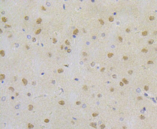 RPA2 Antibody in Immunohistochemistry (Paraffin) (IHC (P))