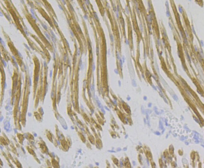 ATP2A1 Antibody in Immunohistochemistry (Paraffin) (IHC (P))