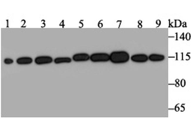 RNF40 Antibody in Western Blot (WB)