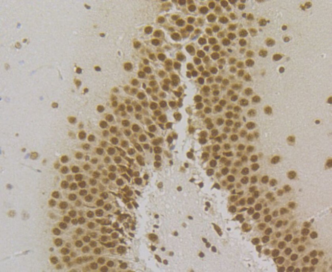 SRSF3 Antibody in Immunohistochemistry (Paraffin) (IHC (P))