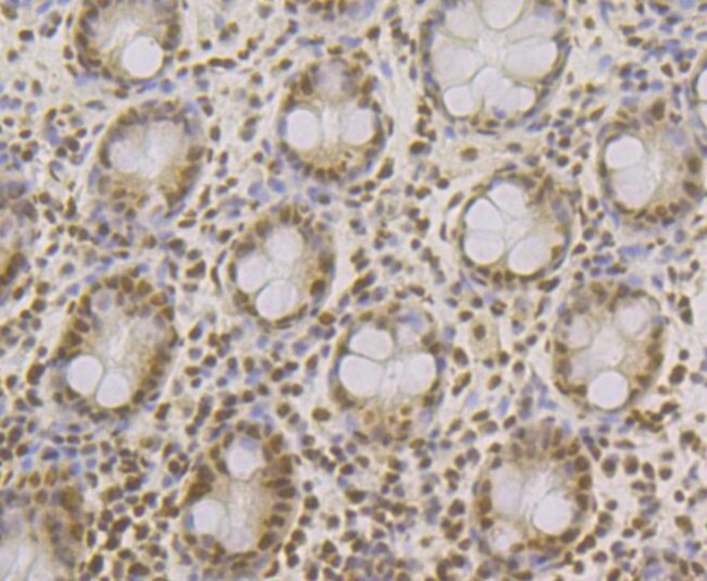 SRSF3 Antibody in Immunohistochemistry (Paraffin) (IHC (P))