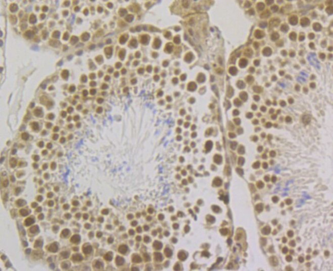 SRSF3 Antibody in Immunohistochemistry (Paraffin) (IHC (P))