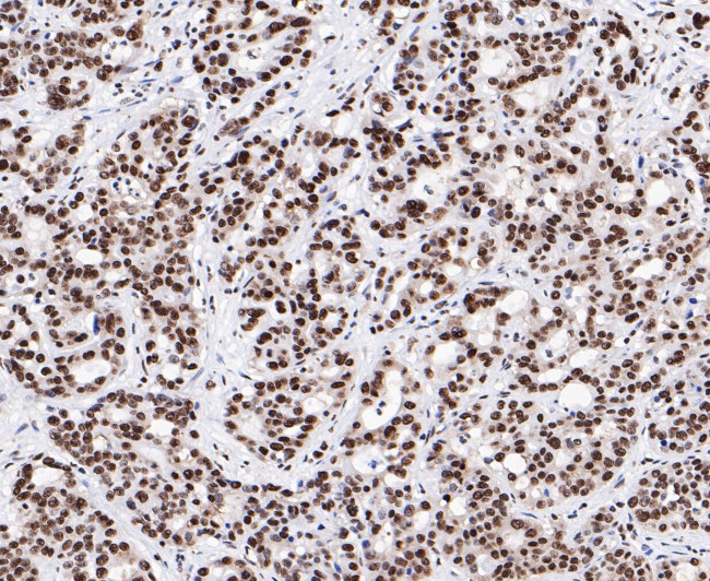 SAM68 Antibody in Immunohistochemistry (Paraffin) (IHC (P))