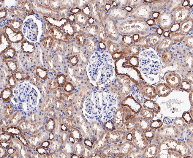 LYPLA1 Antibody in Immunohistochemistry (Paraffin) (IHC (P))