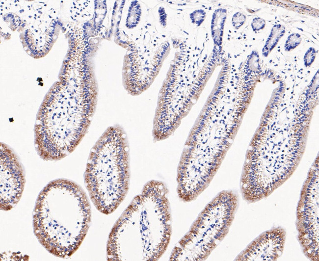 LYPLA1 Antibody in Immunohistochemistry (Paraffin) (IHC (P))