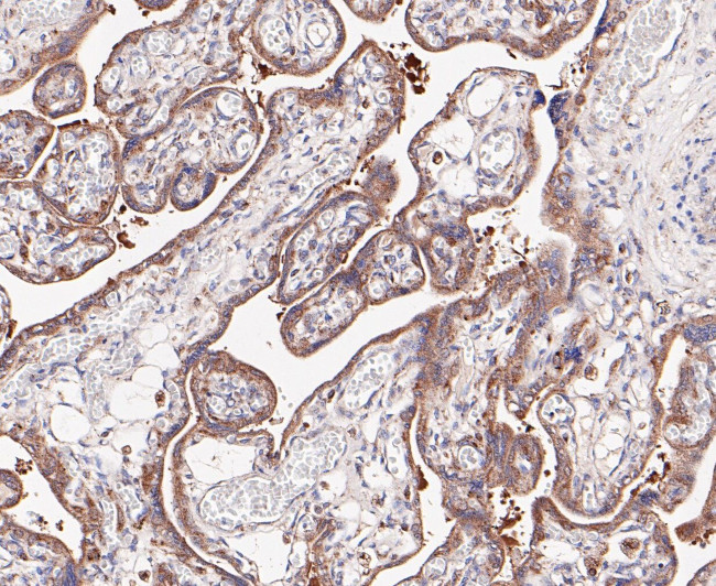 LYPLA1 Antibody in Immunohistochemistry (Paraffin) (IHC (P))