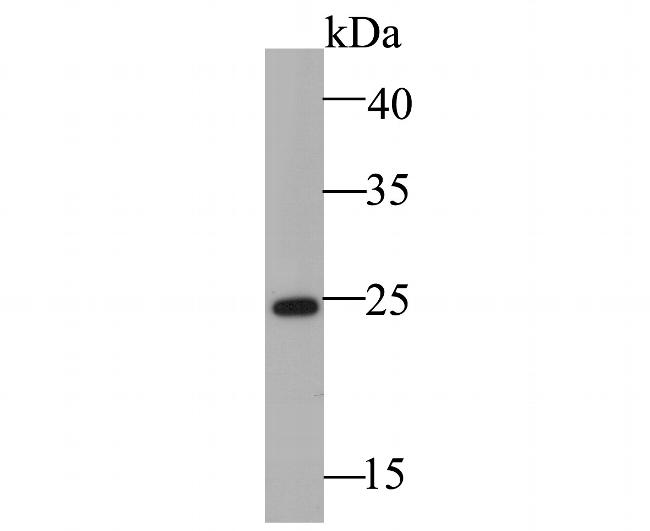 LYPLA1 Antibody in Western Blot (WB)