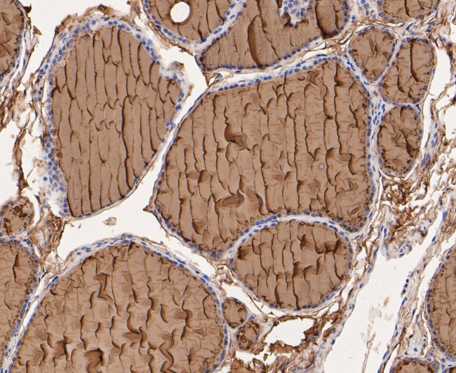 Thyroglobulin Antibody in Immunohistochemistry (Paraffin) (IHC (P))