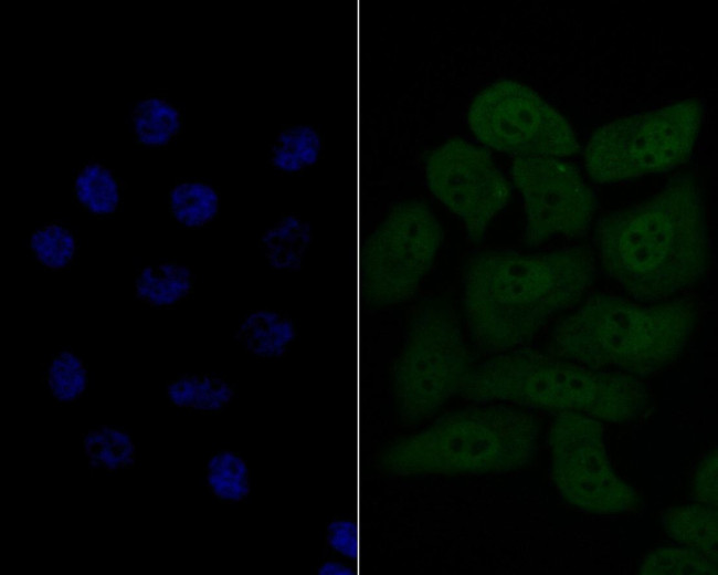 HSF2 Antibody in Immunocytochemistry (ICC/IF)