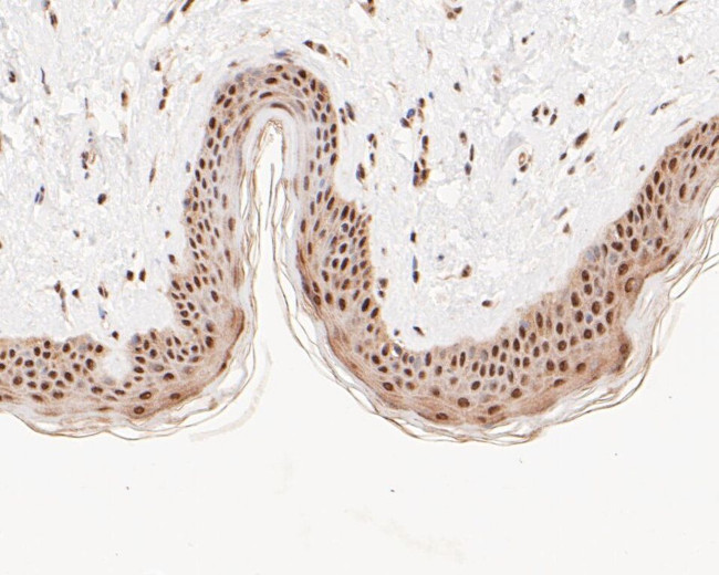 HSF2 Antibody in Immunohistochemistry (Paraffin) (IHC (P))