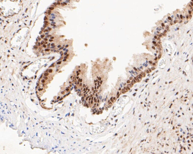 HSF2 Antibody in Immunohistochemistry (Paraffin) (IHC (P))