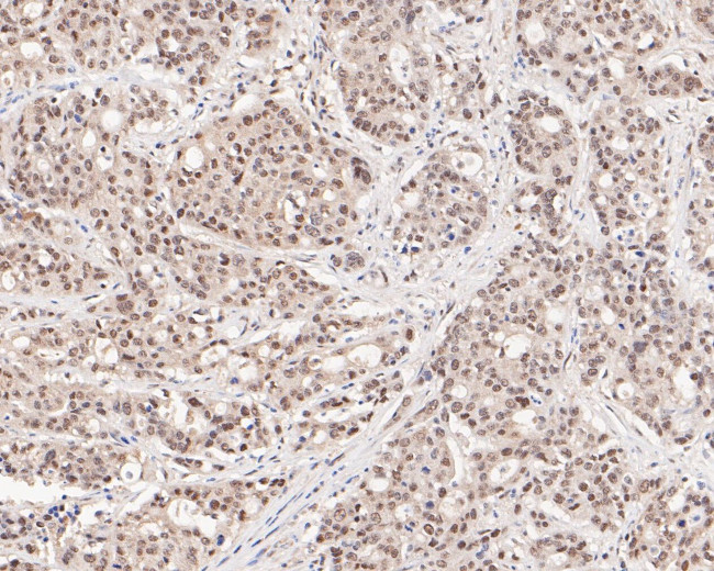 HSF2 Antibody in Immunohistochemistry (Paraffin) (IHC (P))