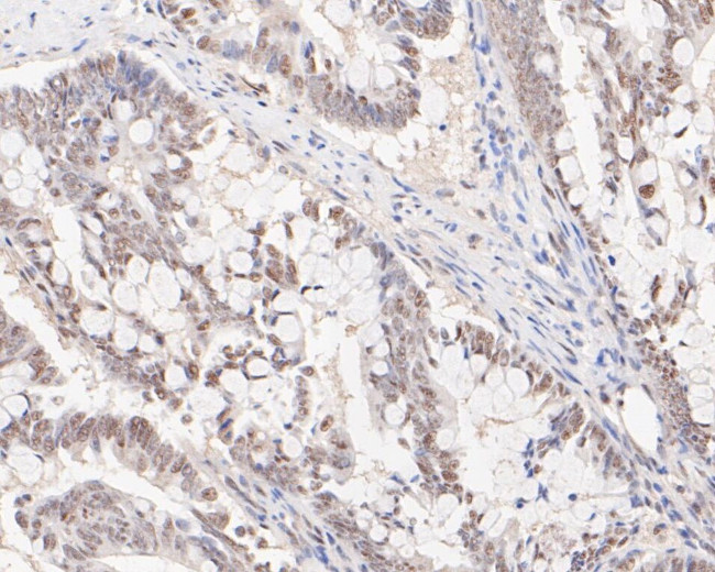 HSF2 Antibody in Immunohistochemistry (Paraffin) (IHC (P))