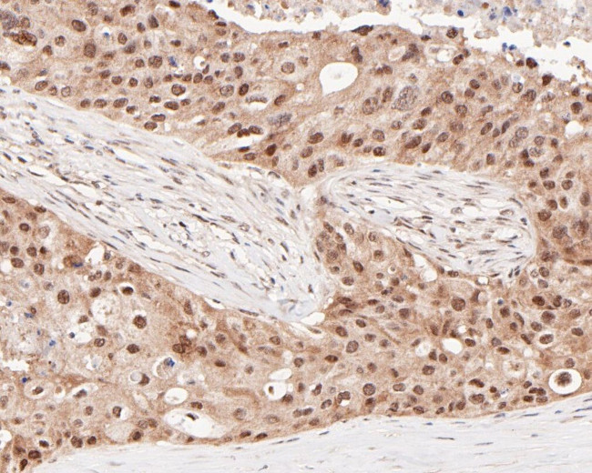 HSF2 Antibody in Immunohistochemistry (Paraffin) (IHC (P))