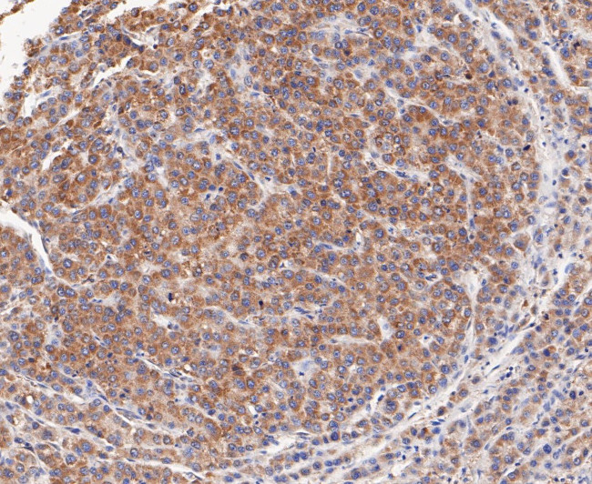 TCP1 Antibody in Immunohistochemistry (Paraffin) (IHC (P))