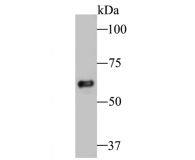 TCP1 Antibody in Western Blot (WB)