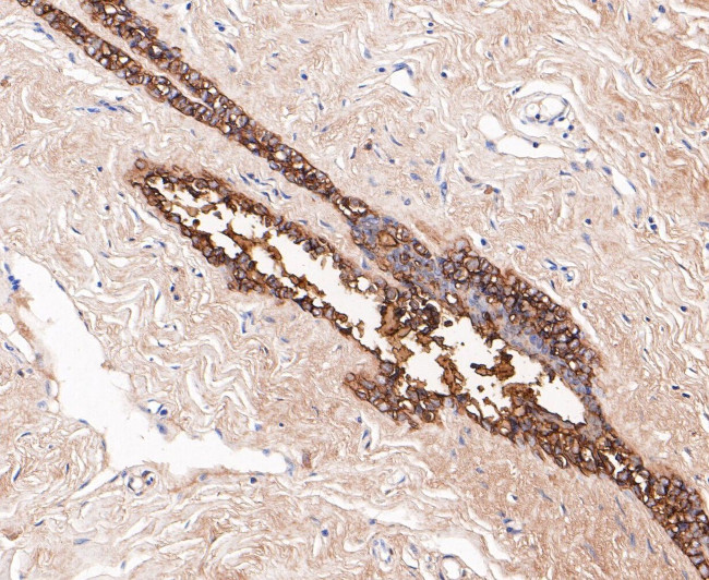 GCDFP-15 Antibody in Immunohistochemistry (Paraffin) (IHC (P))