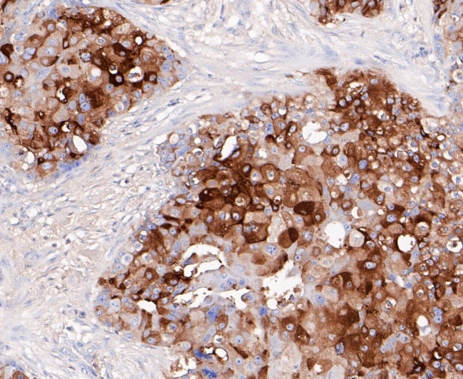 GCDFP-15 Antibody in Immunohistochemistry (Paraffin) (IHC (P))