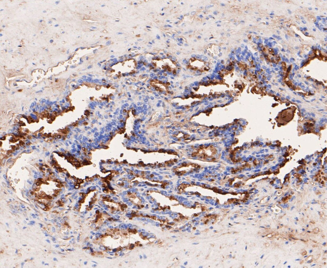 GCDFP-15 Antibody in Immunohistochemistry (Paraffin) (IHC (P))