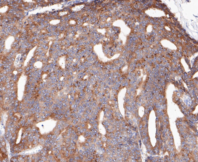 RSK1 Antibody in Immunohistochemistry (Paraffin) (IHC (P))