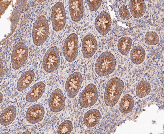 RSK1 Antibody in Immunohistochemistry (Paraffin) (IHC (P))