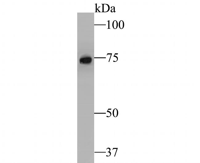 RSK1 Antibody in Western Blot (WB)