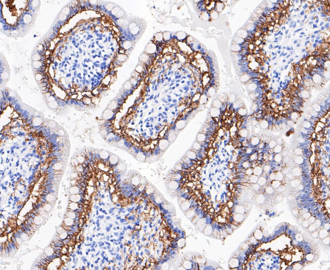 A33 Antibody in Immunohistochemistry (Paraffin) (IHC (P))