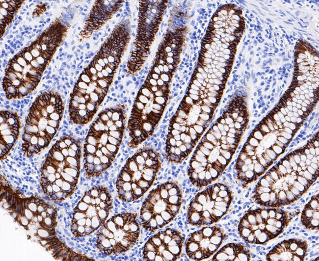 A33 Antibody in Immunohistochemistry (Paraffin) (IHC (P))